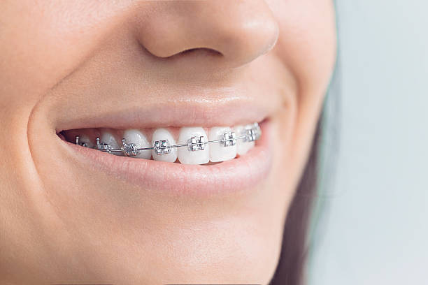 Best Sedation Dentistry  in Bruce, MS